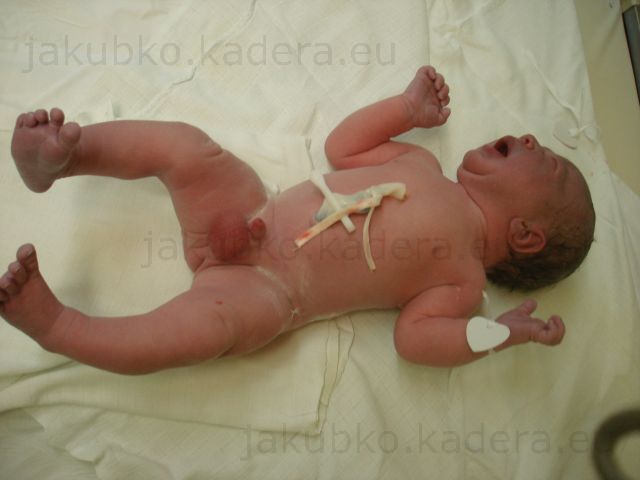 Miško Kadera po pôrode - Miško umytý po pôrode, rýchlo jednu fotku aby mu nebolo zima 12:46